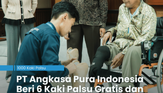 PT Angkasa Pura Indonesia Beri 6 Kaki Palsu Gratis dan masih ada 9 lagi.*