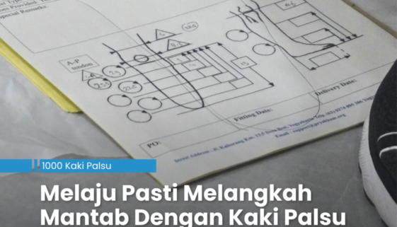Melaju Pasti Melangkah Mantab Dengan Kaki Palsu.