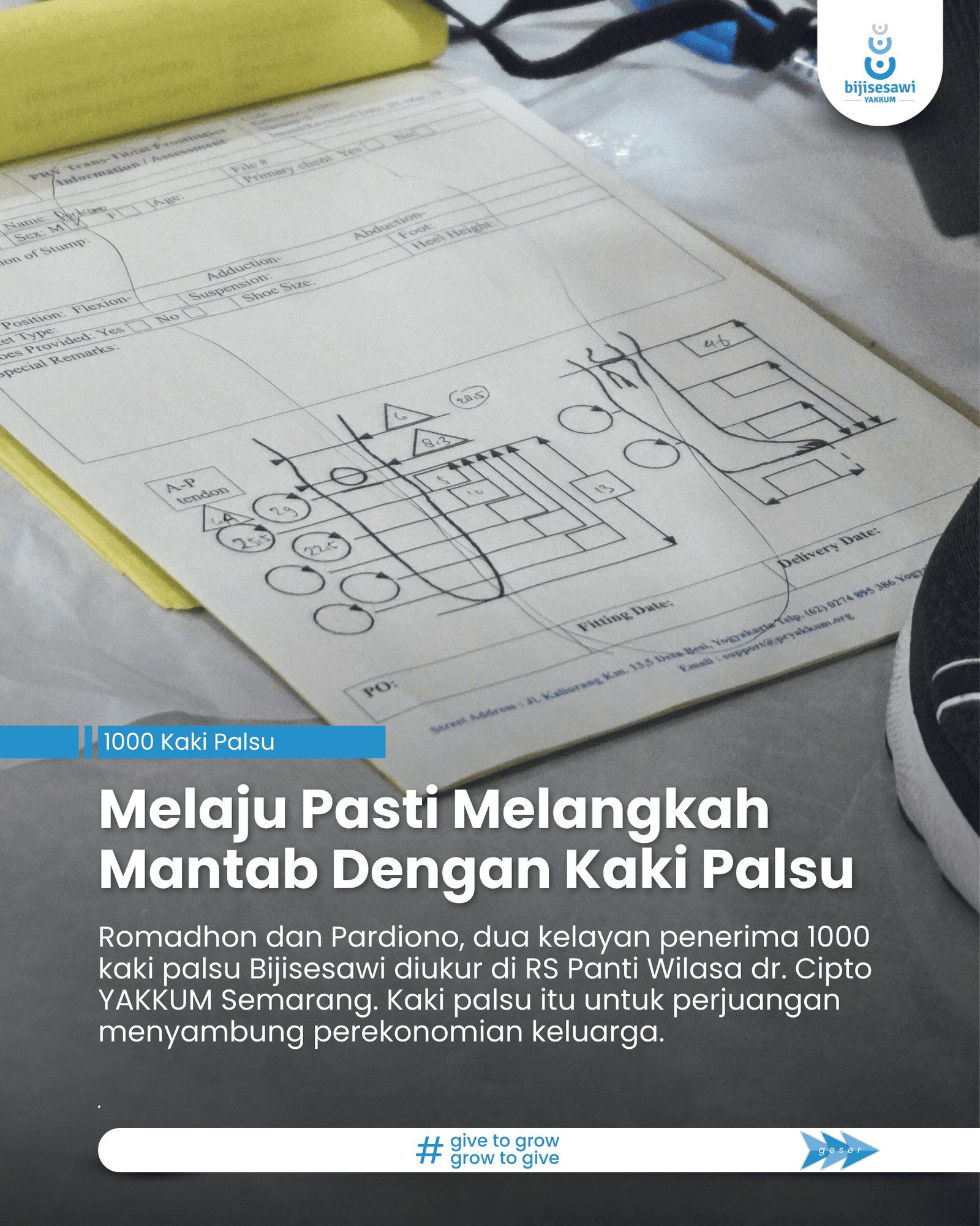 Melaju Pasti Melangkah Mantab Dengan Kaki Palsu.