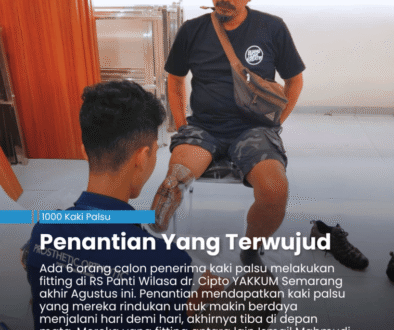 Untung Cahyono sedang duduk di kursi berhadapan dengan Nuel untuk melakukan fitting bagian kaki