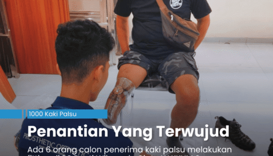 Untung Cahyono sedang duduk di kursi berhadapan dengan Nuel untuk melakukan fitting bagian kaki